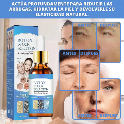 Serum Botox Solution™ - Suero Antiarrugas